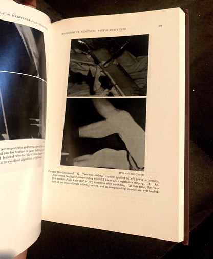 United States Army: Surgery in World War II Orthopedic Surgery Mediterranean